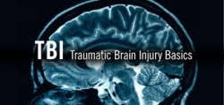 Overview Of Traumatic Brain Injury